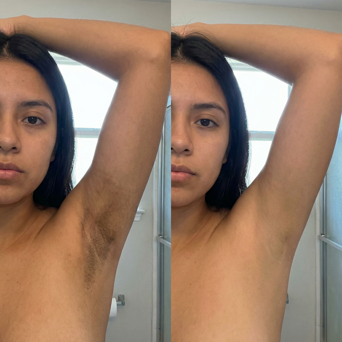 CL-01 Sérum Aclarante