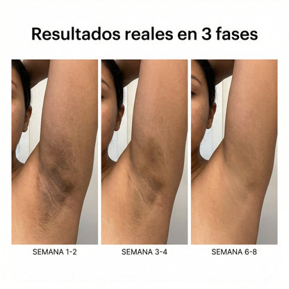 CL-01 Sérum Aclarante